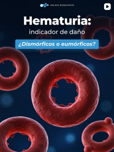 Enlace Bioquímico post about hematuria